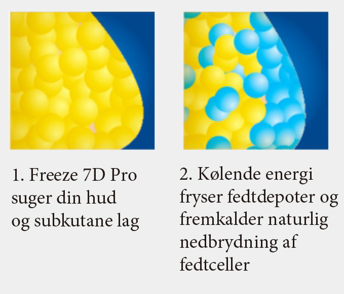 freeze.7d.pro .hvordan.virker.fedtfrysning 1